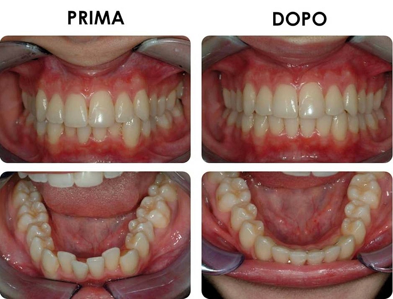 studio picchioni odontoiatria ortodonzia