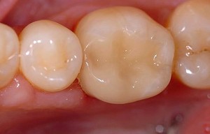 odontoiatria restaurativa