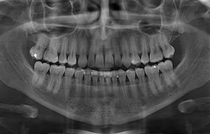 radiologia endorale