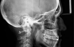 radiologia odontoiatrica